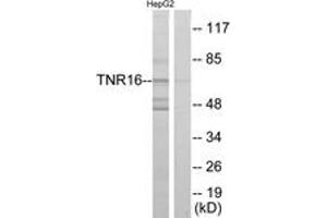 Western Blotting (WB) image for anti-Nerve Growth Factor Receptor (NGFR) (AA 121-170) antibody (ABIN2889383) (NGFR 抗体  (AA 121-170))