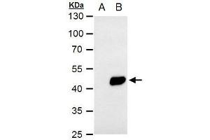 WB Image PDK1 antibody [N1C3] detects PDK1 protein by western blot analysis. (PDK1 抗体)