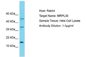 Host: Rabbit Target Name: MRPL30 Sample Tissue: Human Hela Whole Cell Antibody Dilution: 1ug/ml (MRPL30 抗体  (C-Term))
