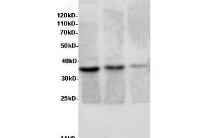 Western Blot analysis of Rat liver, Rat lung tissue and Jurkat cells using AIMP2 Polyclonal Antibody at dilution of 1:600 (AIMP2 抗体)