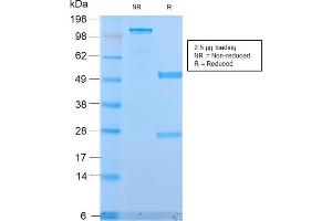 SDS-PAGE (SDS) image for anti-Mucin 1 (MUC1) antibody (ABIN6940113)