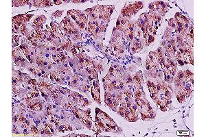 Formalin-fixed and paraffin embedded rat pancreas tissue labeled with Anti-ACE2 Polyclonal Antibody, Unconjugated (ABIN730798) at 1:200, followed by conjugation to the secondary antibody and DAB staining (ACE2 抗体  (AA 601-700))