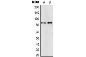 Western blot analysis of APBA2 expression in H4 (A), HeLa (B) whole cell lysates. (APBA2 抗体  (Center))