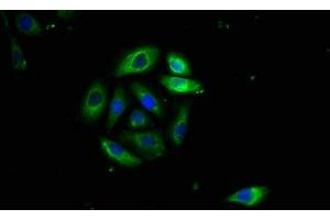 Immunofluorescence staining of A549 cells with ABIN7173891 at 1:400, counter-stained with DAPI. (FAS 抗体  (AA 26-171))