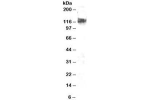Western blot testing of NIH3T3 lysate with CBL antibody at 2ug/ml. (CBL 抗体)