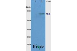 Lane 1: Mouse Liver, lysates Lane 2: Mouse Brain probed with Rabbit Anti-c-Raf(Ser338/Tyr340) Polyclonal Antibody, Unconjugated  at 1:3000 for 90 min at 37˚C. (RAF1 抗体  (pSer338, pTyr340))