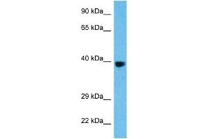 Host:  Rat  Target Name:  FOS  Sample Tissue:  Rat Liver  Antibody Dilution:  1ug/ml (c-FOS 抗体  (C-Term))