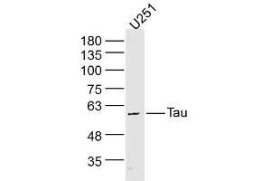 U251 lysates probed with Tau Polyclonal Antibody, Unconjugated  at 1:300 dilution and 4˚C overnight incubation. (tau 抗体)