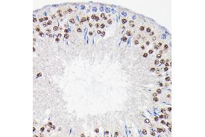 Immunohistochemistry of paraffin-embedded rat testis using PI3 Kinase p85 beta Rabbit mAb (ABIN1679407, ABIN3019246, ABIN3019247 and ABIN7101736) at dilution of 1:100 (40x lens). (PIK3R2 抗体)