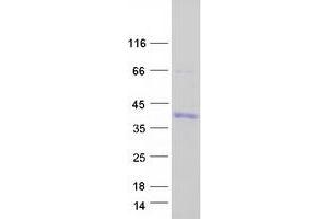 Validation with Western Blot (SNAIL Protein (SNAI1) (Myc-DYKDDDDK Tag))