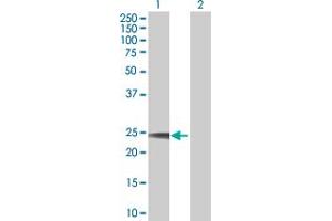 Lane 1: TNFSF8 transfected lysate ( 26 KDa) Lane 2: Non-transfected lysate. (TNFSF8 293T Cell Transient Overexpression Lysate(Denatured))