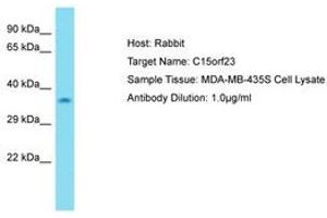 Image no. 1 for anti-Kinetochore-Localized Astrin/SPAG5 Binding Protein (KNSTRN) (AA 31-80) antibody (ABIN6750720) (KNSTRN 抗体  (AA 31-80))