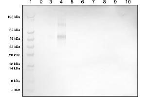 Western blot demonstrating our polyclonal detecting Histamine-BSA conjugate at 1in2000 dilution (1 = Marker, 2 = Histamine-BSA (1 ng), 3 = Histamine-BSA (5 ng), 4 = Histamine-BSA (10 ng), 5 =Blank, 6 = BSA (1 ng), 7 = BSA (5 ng), 8 = BSA (10 ng), 9 =Blank, 10 = Blank) (Histamine 抗体)