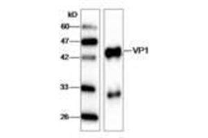 Image no. 1 for anti-Hepatitis A Virus VP1 (HAV VP1) (AA 7-143) antibody (ABIN791617) (HAV VP1 抗体  (AA 7-143))