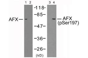 Western blot analysis of extracts from 293 cells using AFX (Ab-197) antibody (E021162, Lane 1 and 2) and AFX (phospho-Ser197) antibody (E011137, Lane 3 and 4). (FOXO4 抗体)