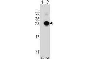 Western Blotting (WB) image for anti-MOB1, Mps One Binder Kinase Activator-Like 1B (MOBKL1B) antibody (ABIN3003175) (MOB1A 抗体)