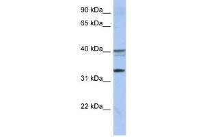 TEX264 antibody used at 1 ug/ml to detect target protein. (TEX264 抗体  (Middle Region))