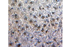 IHC-P analysis of Liver tissue, with DAB staining. (MYB 抗体  (AA 35-291))