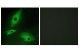 Immunofluorescence (IF) image for anti-Lymphotoxin beta Receptor (TNFR Superfamily, Member 3) (LTBR) (N-Term) antibody (ABIN1849343) (LTBR 抗体  (N-Term))