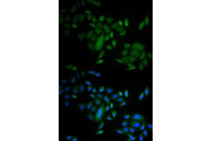Immunofluorescence analysis of A549 cells using CASP9 antibody. (Caspase 9 抗体)