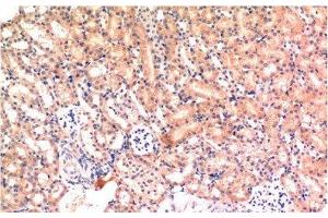 Immunohistochemistry of paraffin-embedded Mouse kidney tissue using Bax Monoclonal Antibody at dilution of 1:200. (BAX 抗体)