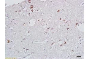 Formalin-fixed and paraffin embedded human brain labeled with Anti- CXCL13/BCA1 Polyclonal Antibody, Unconjugated  at 1:200 followed by conjugation to the secondary antibody and DAB (CXCL13 抗体  (AA 23-109))