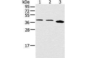 Western blot analysis of Jurkat Hela and 231 cell using CCNG1 Polyclonal Antibody at dilution of 1:400 (Cyclin G1 抗体)