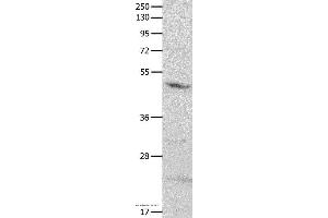 Western blot analysis of Mouse brain tissue, using GNAS Polyclonal Antibody at dilution of 1:500 (GNAS 抗体)