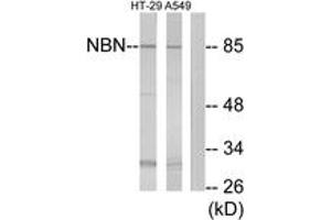 Western Blotting (WB) image for anti-Nibrin (NBN) (AA 431-480) antibody (ABIN2890017) (Nibrin 抗体  (AA 431-480))