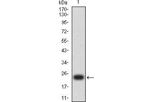 Western blot analysis using MSH6 mAb against human MSH6 (AA: 374-540) recombinant protein. (MSH6 抗体  (AA 374-540))