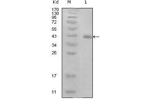 HPV16 E7 抗体