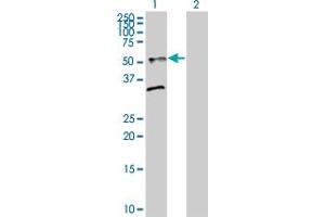 Lane 1: ST8SIA2 transfected lysate ( 40. (ST8SIA2 293T Cell Transient Overexpression Lysate(Denatured))