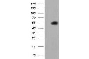 HEK293T cells were transfected with the pCMV6-ENTRY control (Left lane) or pCMV6-ENTRY SMAD2 (Right lane) cDNA for 48 hrs and lysed. (SMAD2 抗体)