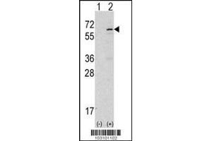 Image no. 1 for anti-tyrosine Kinase, Non-Receptor, 2 (TNK2) (AA 934-964) antibody (ABIN2451837) (TNK2 抗体  (AA 934-964))