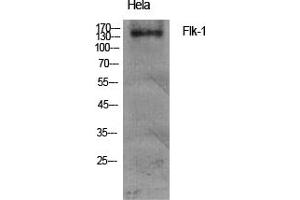 Western Blotting (WB) image for anti-VEGF Receptor 2 (VEGFR2) (Tyr951) antibody (ABIN5961553) (VEGFR2/CD309 抗体  (Tyr951))