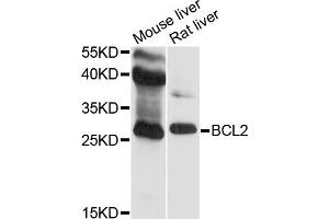 Western blot analysis of extracts of various cell lines, using BCL2 antibody (ABIN5970041) at 1/500 dilution. (Bcl-2 抗体)