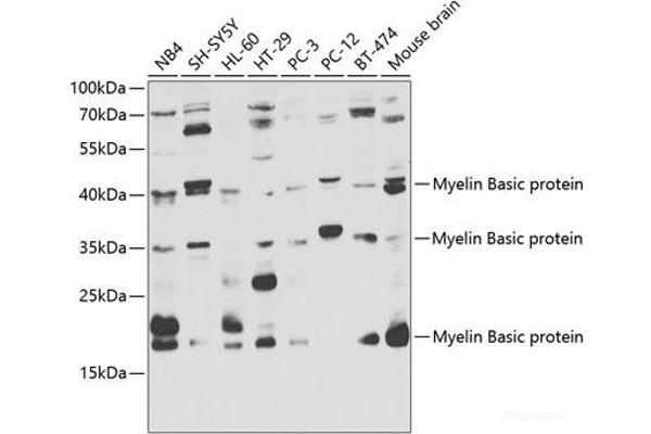 MBP 抗体