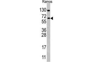 Western blot analysis of anti-CDC25B Antibody (Center) in Ramos cell line lysates (35 µg/lane). (CDC25B 抗体  (Center))