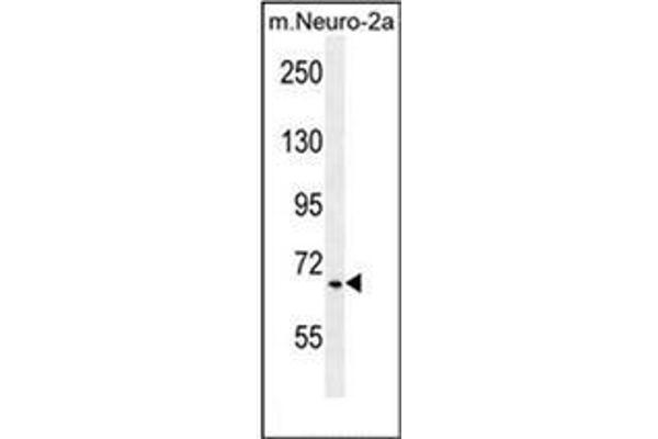 Primary Ciliary Dyskinesia Protein 1 (PCDP1) (AA 508-538), (C-Term) 抗体