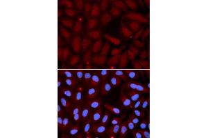 Immunofluorescence analysis of U2OS cell using SFTPC antibody. (Surfactant Protein C 抗体  (AA 1-197))