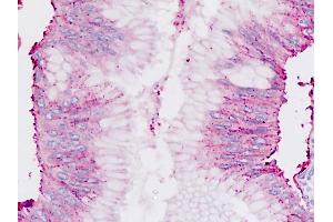 Human Pancreas: Formalin-Fixed, Paraffin-Embedded (FFPE) (Chordin 抗体  (C-Term))