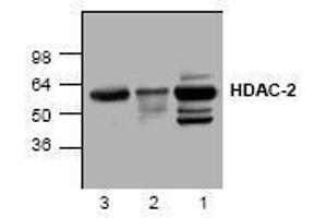 Image no. 1 for anti-Histone Deacetylase 2 (HDAC2) antibody (ABIN127234) (HDAC2 抗体)