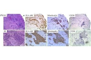 HLA-ABC identifies cells of human origin in xenografted mice. (ATPase Beta3 (Center) 抗体)