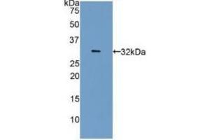 Detection of Recombinant CA4, Human using Polyclonal Antibody to Carbonic Anhydrase IV (CA4) (CA4 抗体  (AA 19-283))