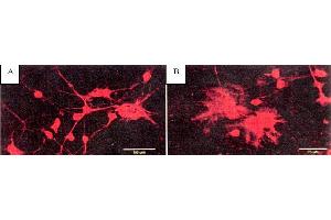 Image no. 1 for anti-BAPTA antibody (ABIN264974) (BAPTA 抗体)