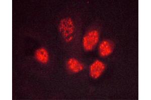ABIN6267495 staining Hela cells by ICC/IF. (PPARG 抗体  (pSer112))
