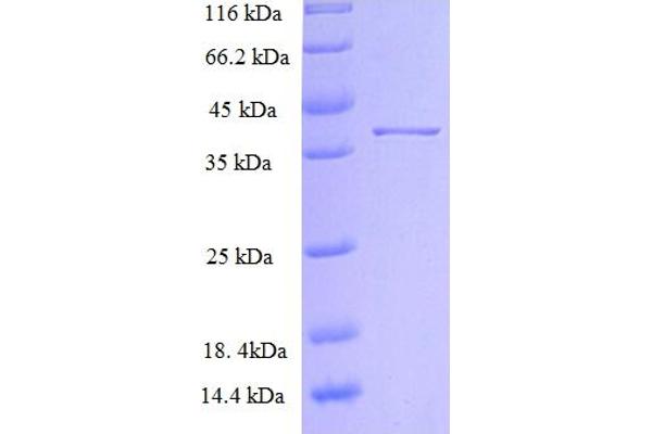 SLC39A13 Protein (AA 130-233) (His-GST)