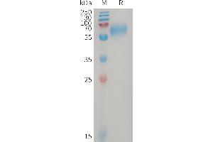 Human Protein, His Tag on SDS-PAGE under reducing condition. (GPR56 Protein (AA 26-402) (His tag))