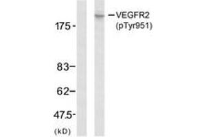 Western Blotting (WB) image for anti-VEGF Receptor 2 (VEGFR2) (pTyr951) antibody (ABIN2888557) (VEGFR2/CD309 抗体  (pTyr951))