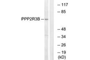 Western blot analysis of extracts from K562 cells, using PPP2R3B Antibody. (PPP2R3B 抗体  (AA 364-413))